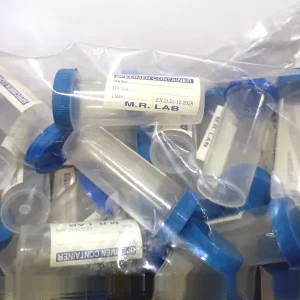 Standard Urine Collection Pot for Hospitals & Clinics